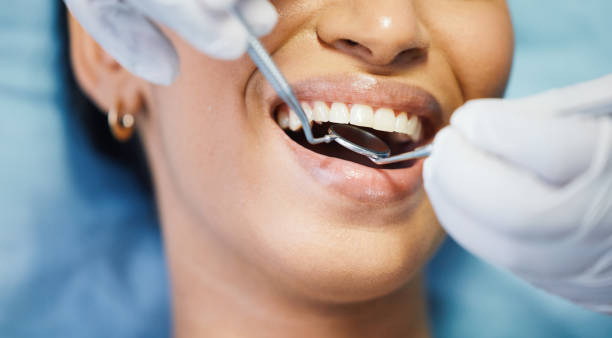 Best Knocked-Out Tooth Emergency  in Baldwin, NY